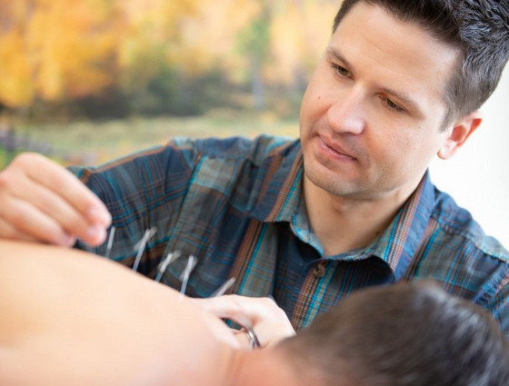 Image of a man inserting acupuncture needles